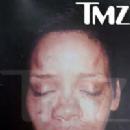 Rihanna - TMZ photo with bruises after fight with Chris Brown