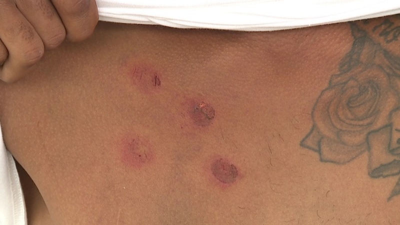 'I want their badges': Man shot with pepper balls by IMPD tells his side of story