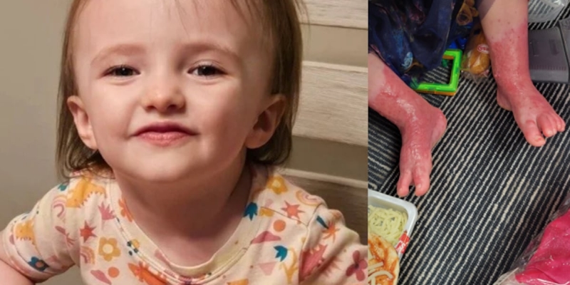 Mom seeking jail time for day care owner accused of burning child in scalding hot water